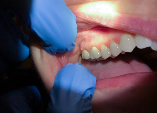 Best Mobile Emergency Dentist in Augusta, AR